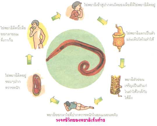 พยาธิเส้นด้าย